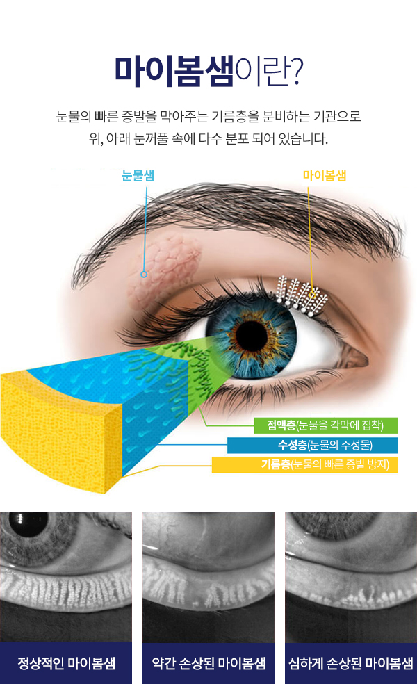 Ǻ䥱