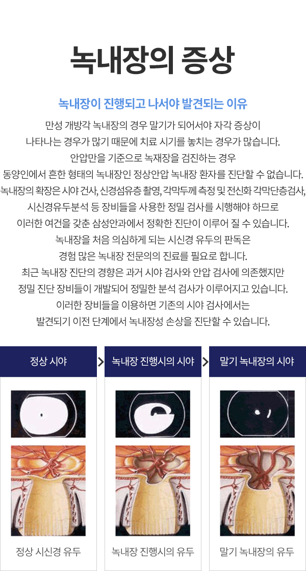 쳻  