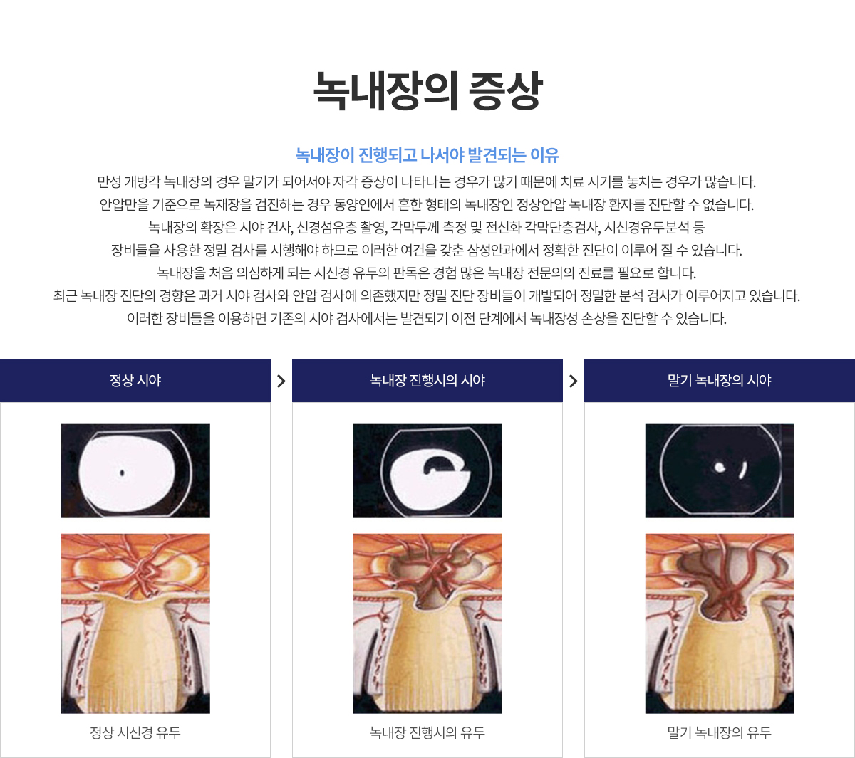 쳻  
